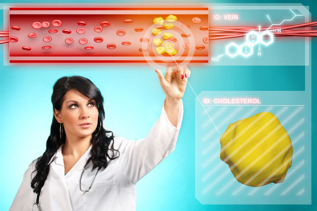 他汀|降血脂只知道他汀、贝特类？这3个新药机制独特显优势，事半功倍