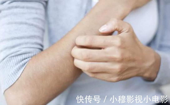 检查|身体2处“发痒”,别以为只是过敏,或是肝脏异常,尽早去检查