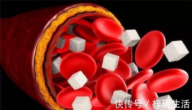 多喝水|高血脂的人日常需要有哪些忌口？专家提醒：这3种食物需要注意