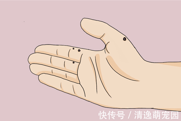 糖尿病|肝硬化先上手脚，手脚的哪些变化，暗示了肝硬化可能找上门了？