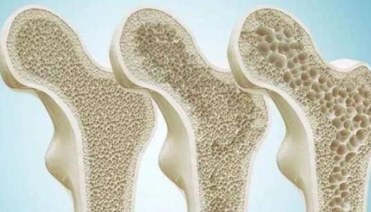 补钙|吃虾皮可以补钙医生真正补钙的是这4种食物，很多人却不爱吃