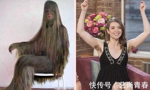 毛发|世界上体毛最多的女孩完成了人猿逆袭,脱毛后变美女,不可思议
