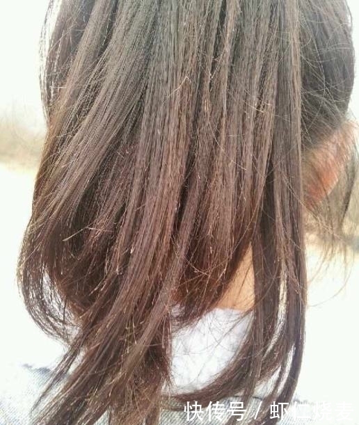 太阳穴|头发若有这四种表现,意味着你的肝脏可能在“中毒”,别不当回事