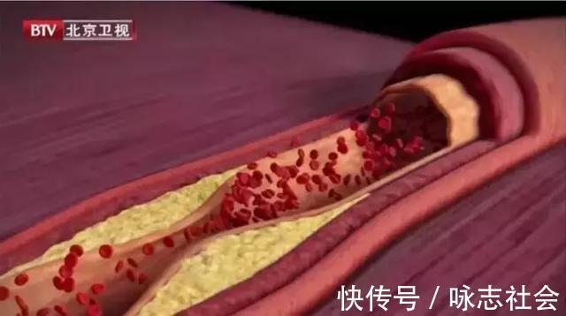 海带泡|它才是名副其实的“长寿菜”!降三高、强免疫、防痴呆早吃早受益