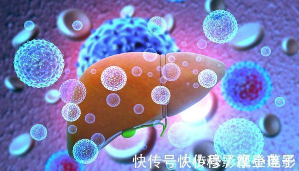 饮水量|肝硬化来临时,通常会有这4种异常,占一个,也要引起注意