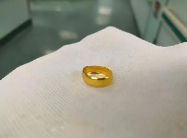 可可|满月婴儿手上戴满“金戒指”,误吞一只险些悲剧,爸妈长点心吧