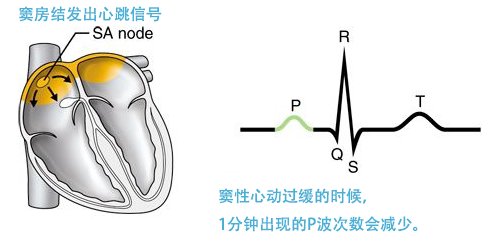 窦性心动过缓|官方认定「心动过缓」的标准,心跳慢到什么程度要看医生?