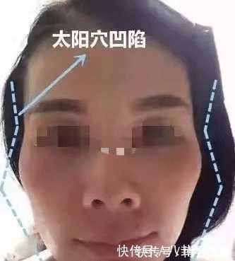 长相|娱乐圈吹捧的“高颧骨”长相,为何放在普通人身上却显老又刻薄