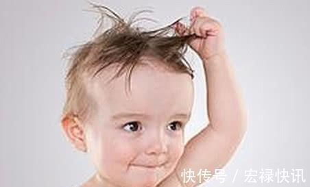 宝宝|宝宝爱晃脑袋,宝妈误以为是缺钙,去医院检查才知道有异常