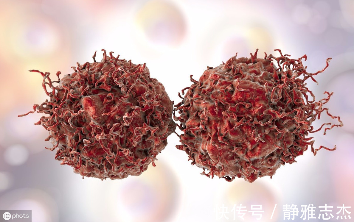 维生素c|全国每年约80万人死于癌症,它是“抗癌冠军”,早点知