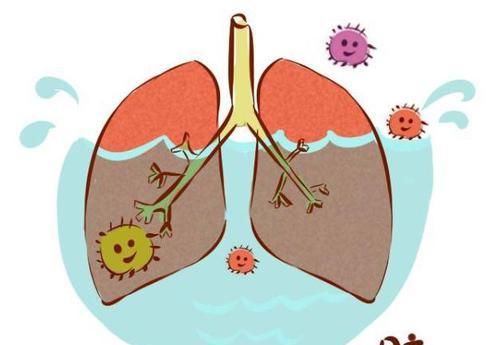  肺癌|当以下4个症状找上自己时，肺癌或已进入了中晚期，及时就医