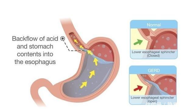 黄金期|养胃“黄金期”，常喝1水，多吃3果，胃或许会慢慢变好