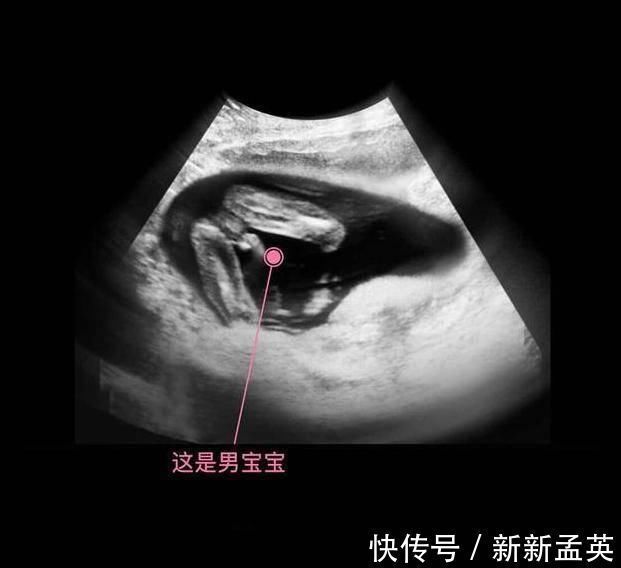 胚胎|胎儿从卵泡到性别形成,17张图片清晰诠释,男宝女宝看得很清楚