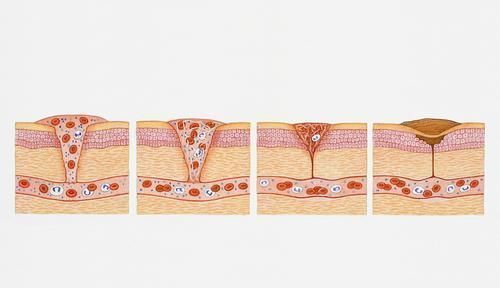 一物|血脂的“帮凶”找到了，主任医生每天补一物，坚持半月，血管净