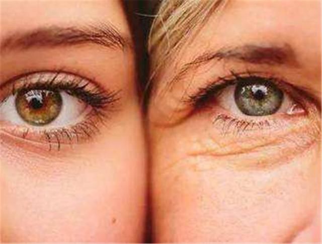 美女|曾经那些割了双眼皮的美女,10年后会变啥样,看完还敢割吗?