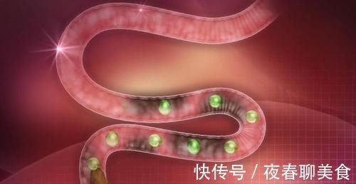 便秘|经常便秘、拉不出?试试多吃6样食物,或能让你甩掉便秘一身轻