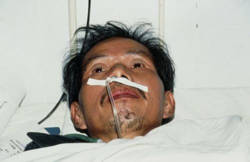 肺部疾病|肺部有癌，喉咙先知？出现3个喉咙信号，别当成咽炎，尽早检查肺