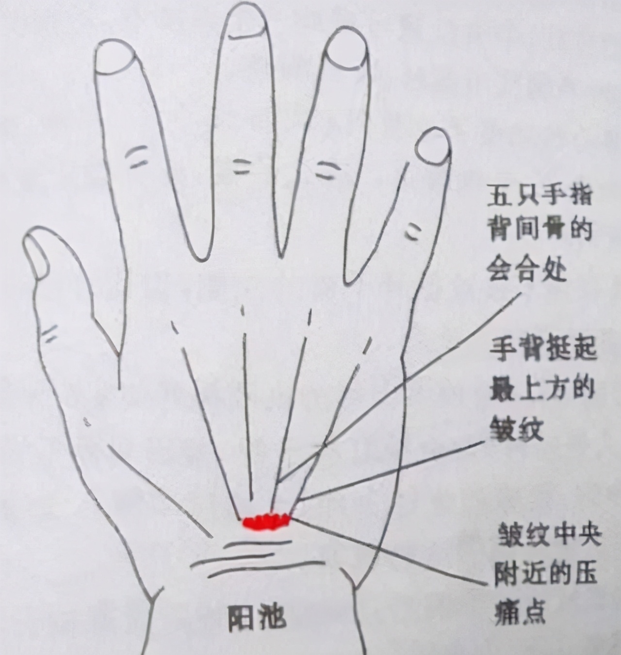 阳池穴|血糖高的人,身体3处有问题,若一个不占,血糖还算稳定