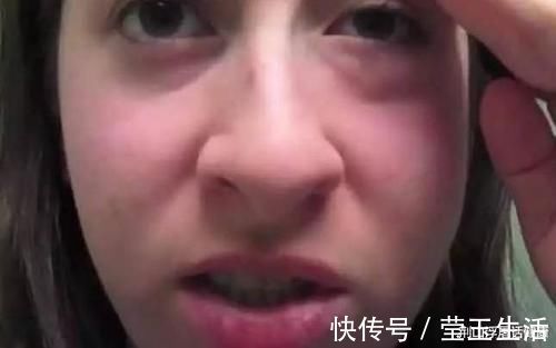 尿酸|高尿酸“害怕”1物,并不是冬瓜,你若爱吃,尿酸或会听话