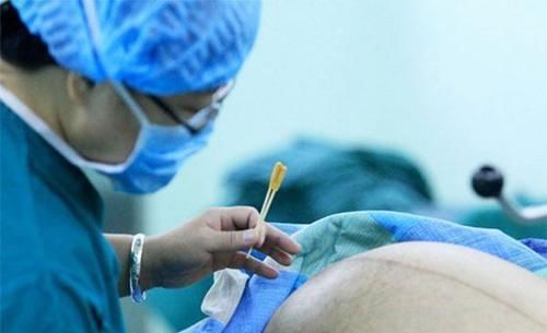 足月|足月37周跟40周有区别吗?医生:肚子里多待一天,比外面十天都强