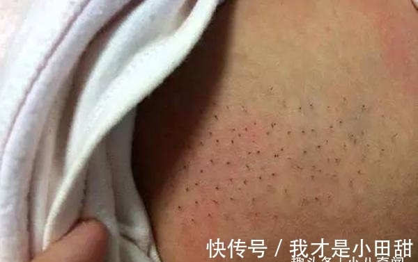 夫妻俩|儿子身上长满了“毒刺”,父母慌忙带到医院检查,医生:愚昧!