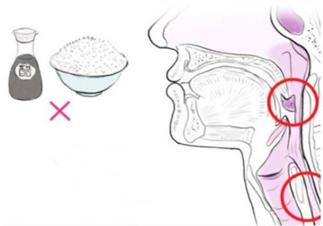 急救|宝宝吃鱼被鱼刺卡喉，妈妈1分钟急救措施，医生听完竖拇指夸赞