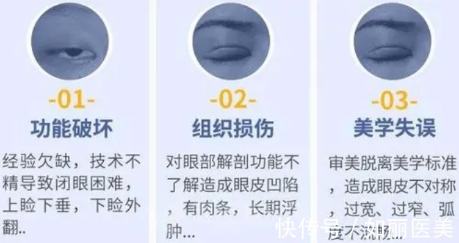 我们来了 双眼皮手术后遗症：宽、深、痕，这些现象很常见！