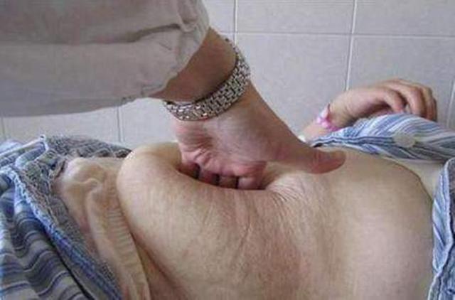 麻醉针|选剖腹产不疼这根10厘米的麻醉针仅仅是开始,疼到你怀疑人生