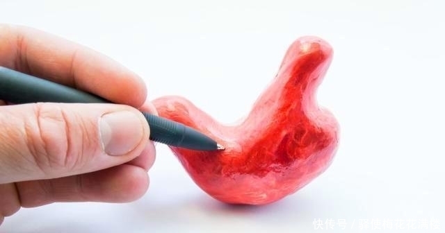 早期的时|胃癌早期不痛不痒身体发出这四个“信号”,多半是它来了