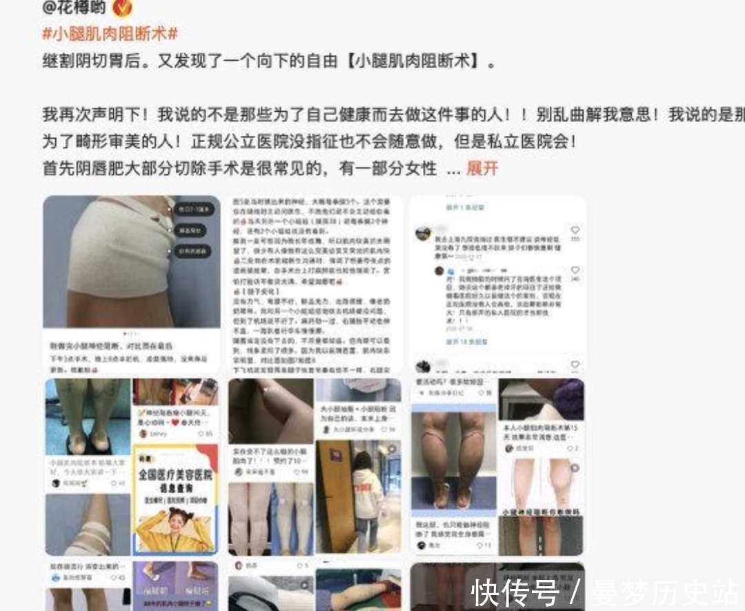 猴相|好奇葩……