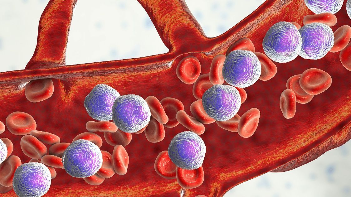 食物|为什么得白血病的人越来越多?或与3类常见食物有关,要少吃