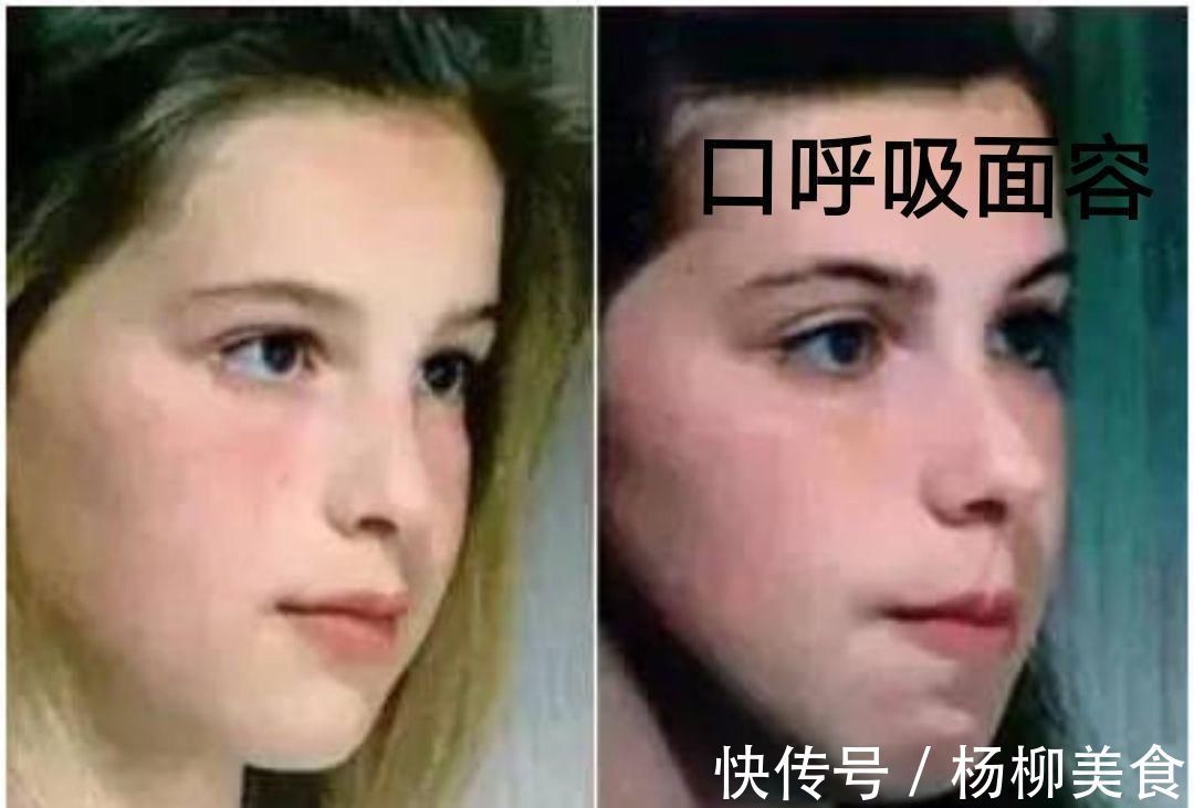 呼吸道|女儿被同学嘲笑像“青蛙”，妈妈没当一回事，朋友提醒才带去检查