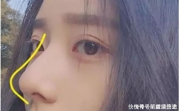 鼻子上挤出“白色条状物”?学会这3招,从此告别“草莓鼻”!