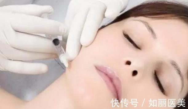 整形医生 整形医生自己也会做的医美项目,这几个是“心头爱”?真让人意外