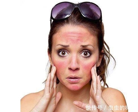 别再傻傻的晒太阳，晒太阳带给你的不只是黑，还有这些