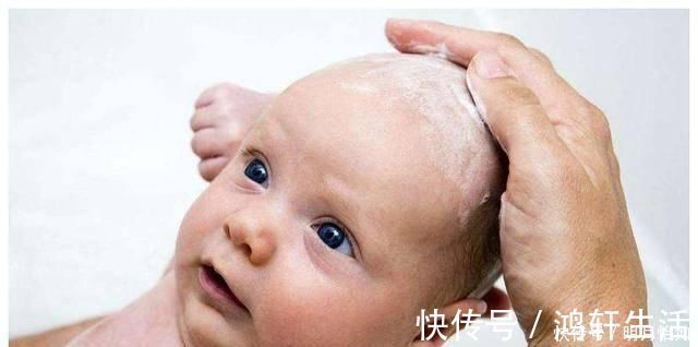 囟门|儿科医生囟门是宝宝健康晴雨表,4项误区,6种异常要牢记