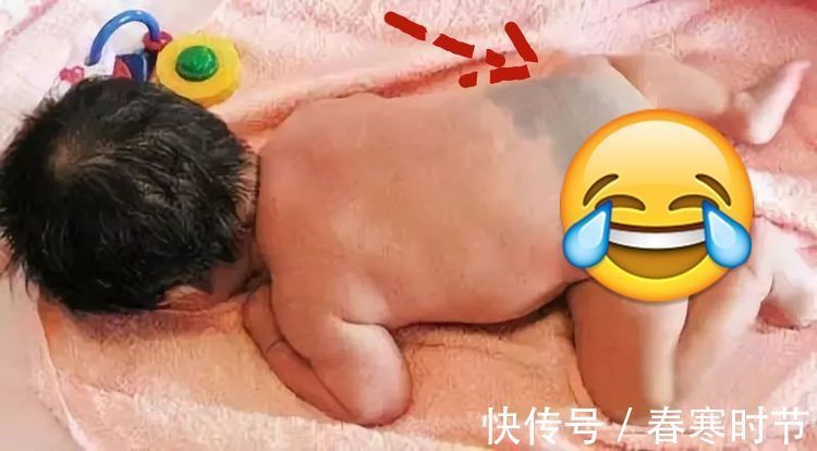林静|宝宝出生屁股“淤青”,不要以为是天生,可能宝妈孕期做了这些事