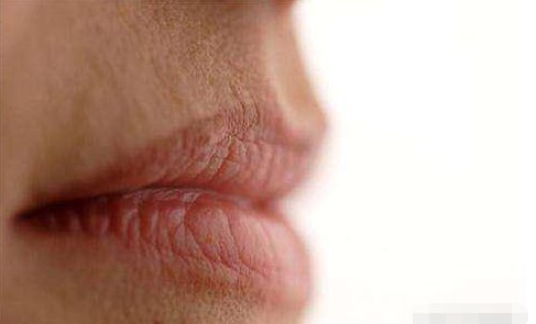 嘴唇干燥，皲裂，同时口干口臭，一个方法就搞定