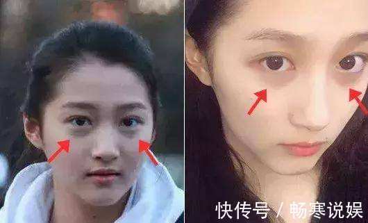 何首乌|三味药泡茶喝,坚持半个月,黑眼圈、眼袋通通全消失,越变越美