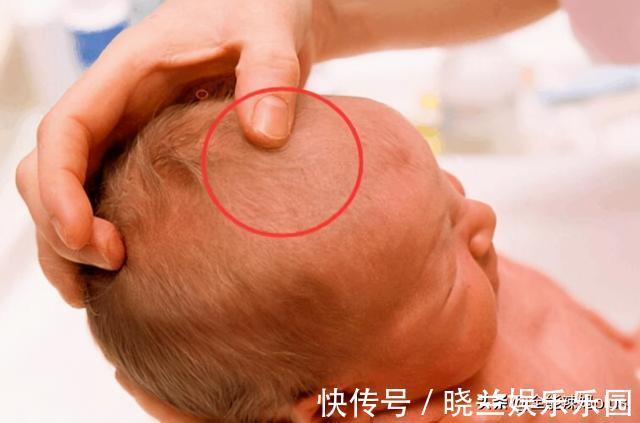 头围|宝宝囟门是健康“灯塔”,若出现几种信号,可能健康亮了“红灯”