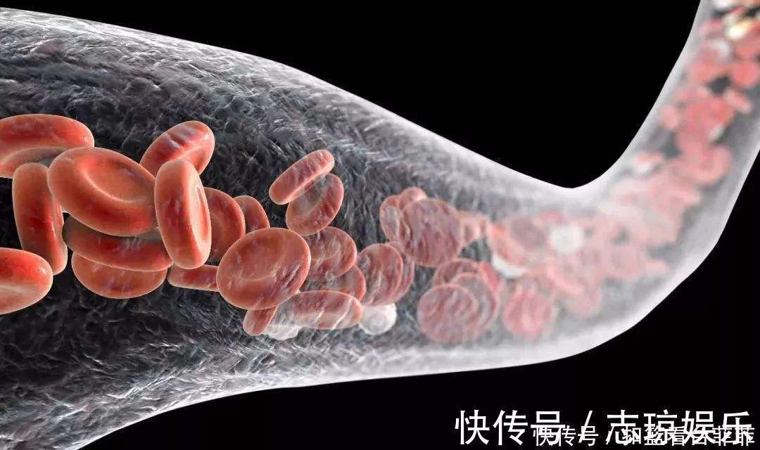 高脂血症|心血管大夫：降血脂很简单，1种“零食”紧着吃，血管通畅人精神