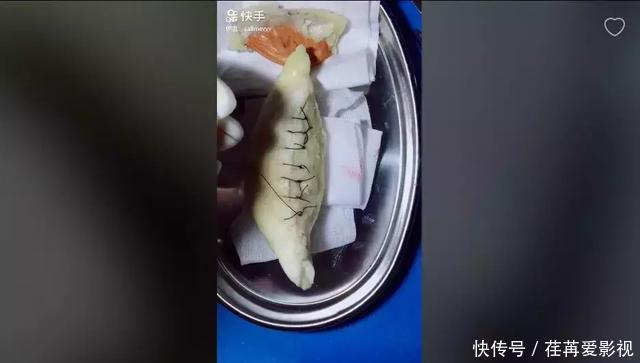 王醫生|32歲醫生竟給水果做手術？一夜吸粉12萬！網友：“我的膝蓋跪爛了”