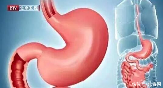 常吃面条究竟是养胃还是伤胃？