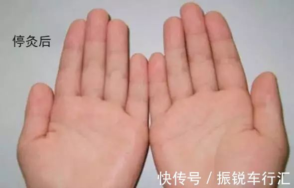 汗腺|汗从哪里出,病从哪里来!夏天爱出汗的,快对照看看吧!