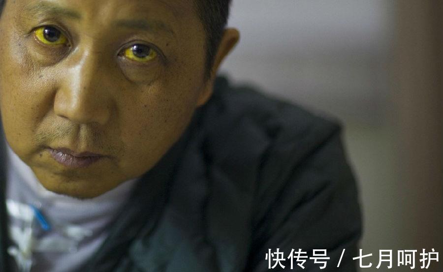 肝脏|肝不好的人,不能吃羊肉吗?医生:不止羊肉,这3种肉尽可能不吃