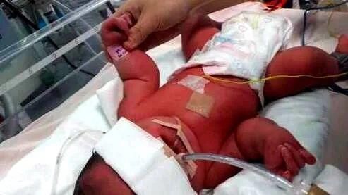 产妇|准妈妈不惜一切的去保护孩子,孩子出生后,产妇却当场被吓晕