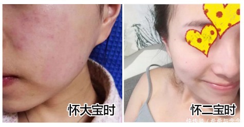 二胎辣妈爆火的怀孕护肤“3+2法则”！精明孕妈才能越孕越美丽！