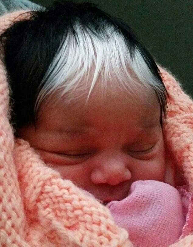 白毛|女婴生下来头上有一撮白毛,医生嘲笑,宝妈却乐坏了