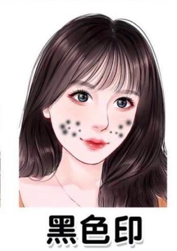 掌握6种痘印去除指南,不要“月球脸”,轻松养成“牛奶肌”