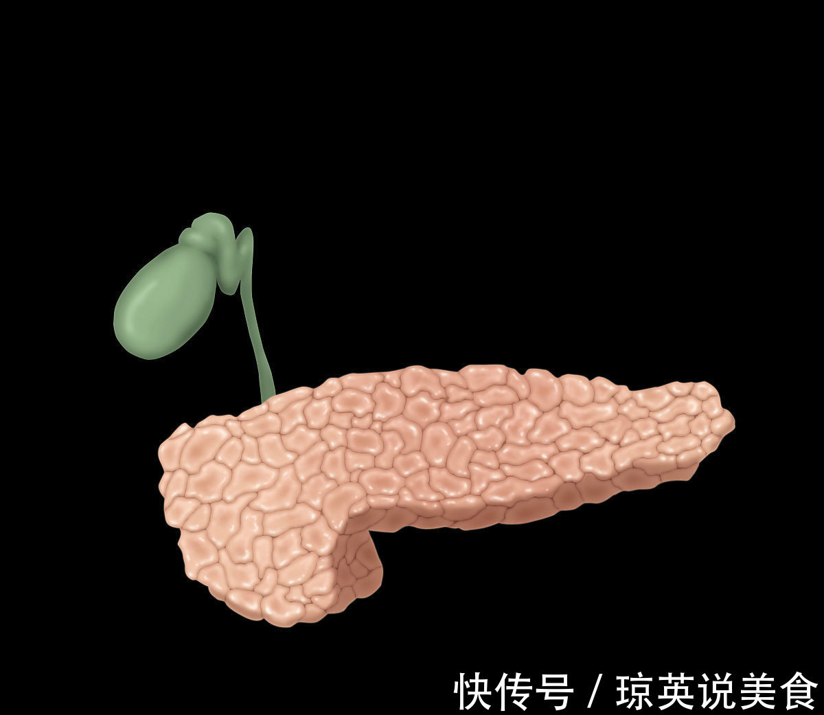 胰头癌|三个症状不断出现，十有八九是胰腺癌，最好去检查一下